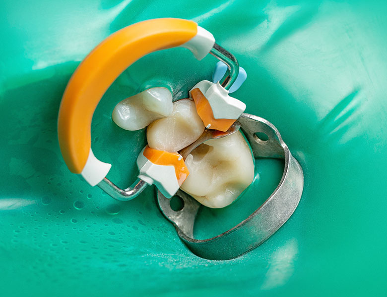 千葉県茂原市の歯医者、たけ歯科クリニックの小児歯科