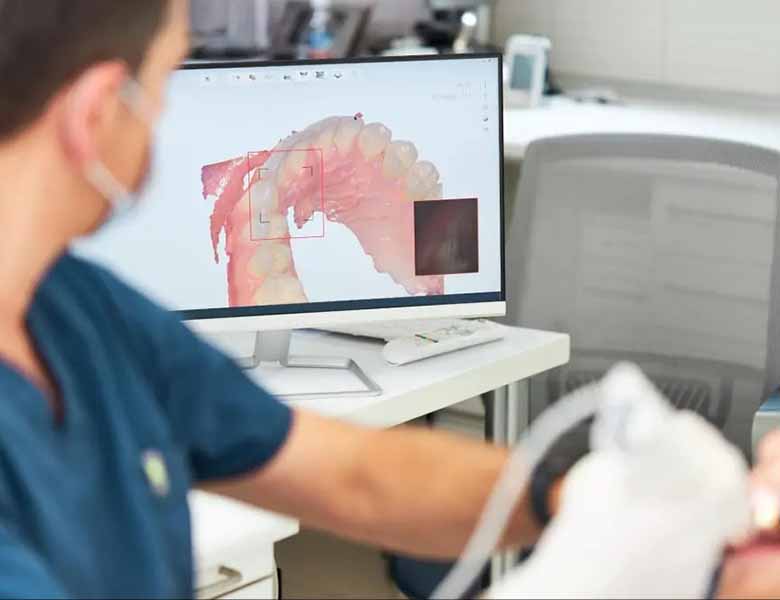 千葉県茂原市の歯医者、たけ歯科クリニックの口腔内スキャナー