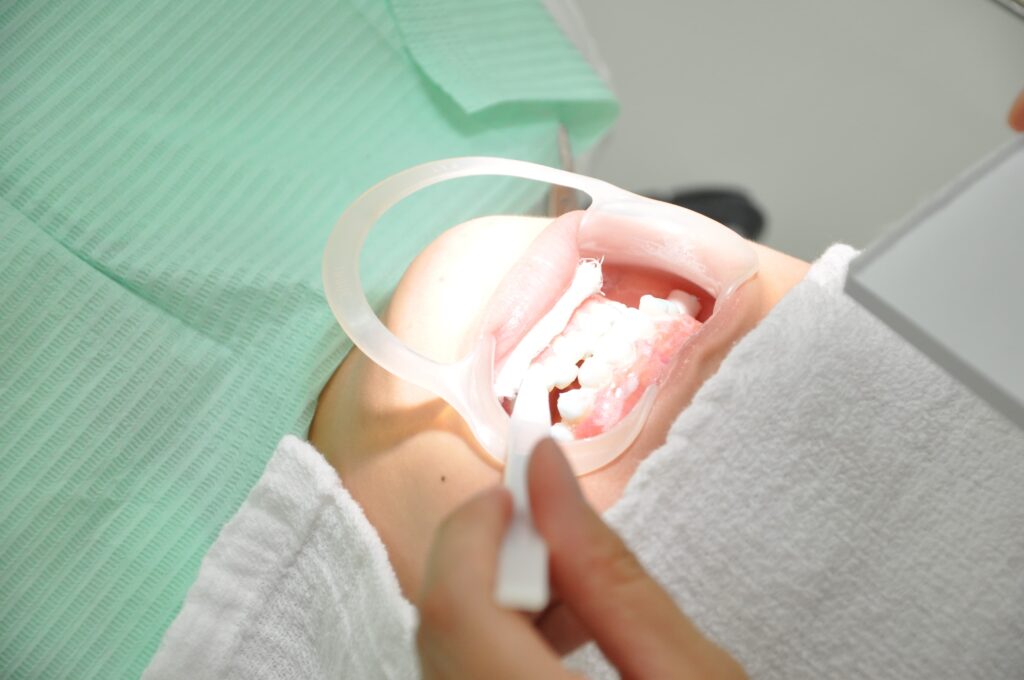 千葉県茂原市の歯医者、たけ歯科クリニックのホワイトニング