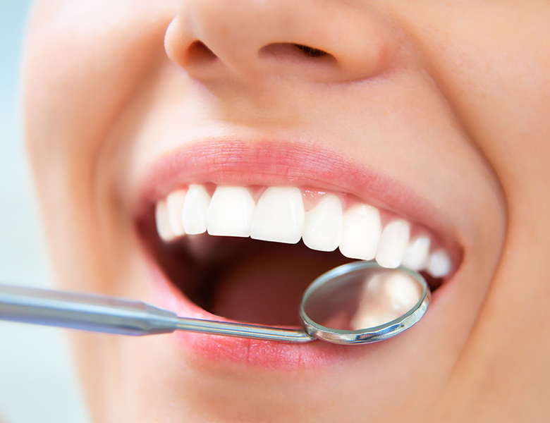 千葉県茂原市の歯医者、たけ歯科クリニックの予防歯科